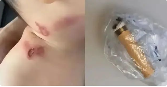 嬰兒被高空拋下煙頭燙傷：高空拋物的人都是什么心理？