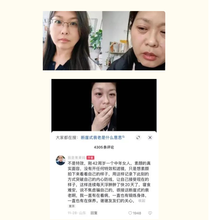斷崖式衰老女子確診卵巢早衰，生活習(xí)慣是衰老“加速器”